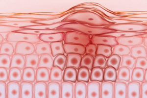 New Treatment For Cancer