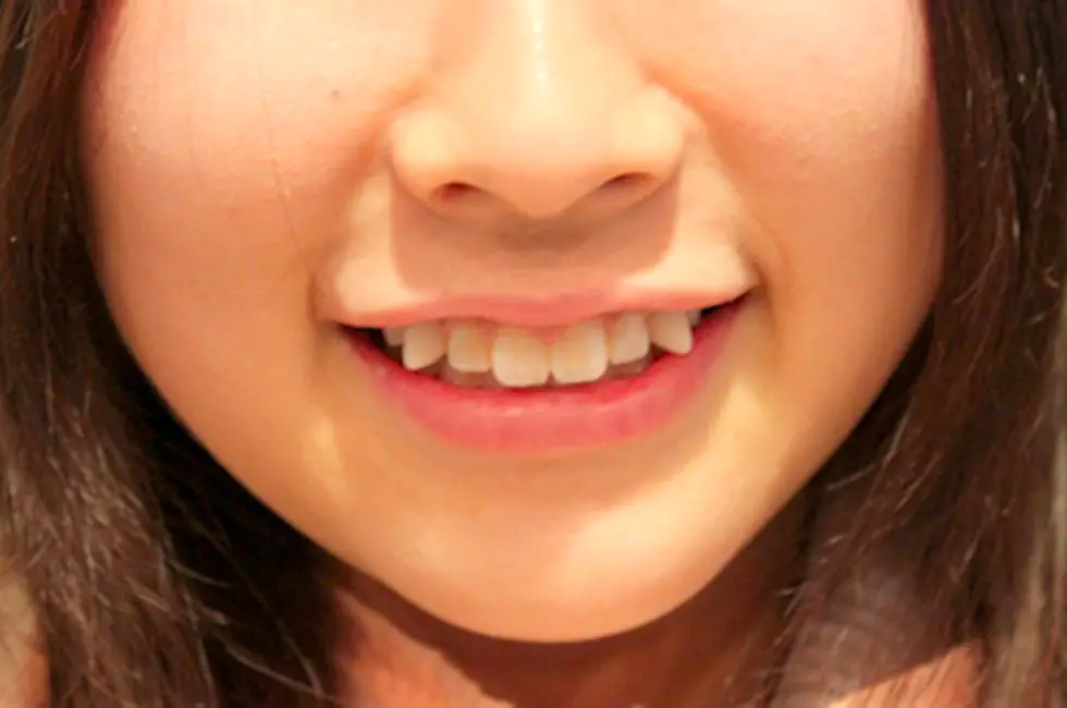 YAEBA TEETH- JAPAN 